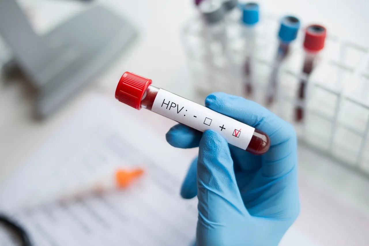 Exame pode identificar infecção por HPV