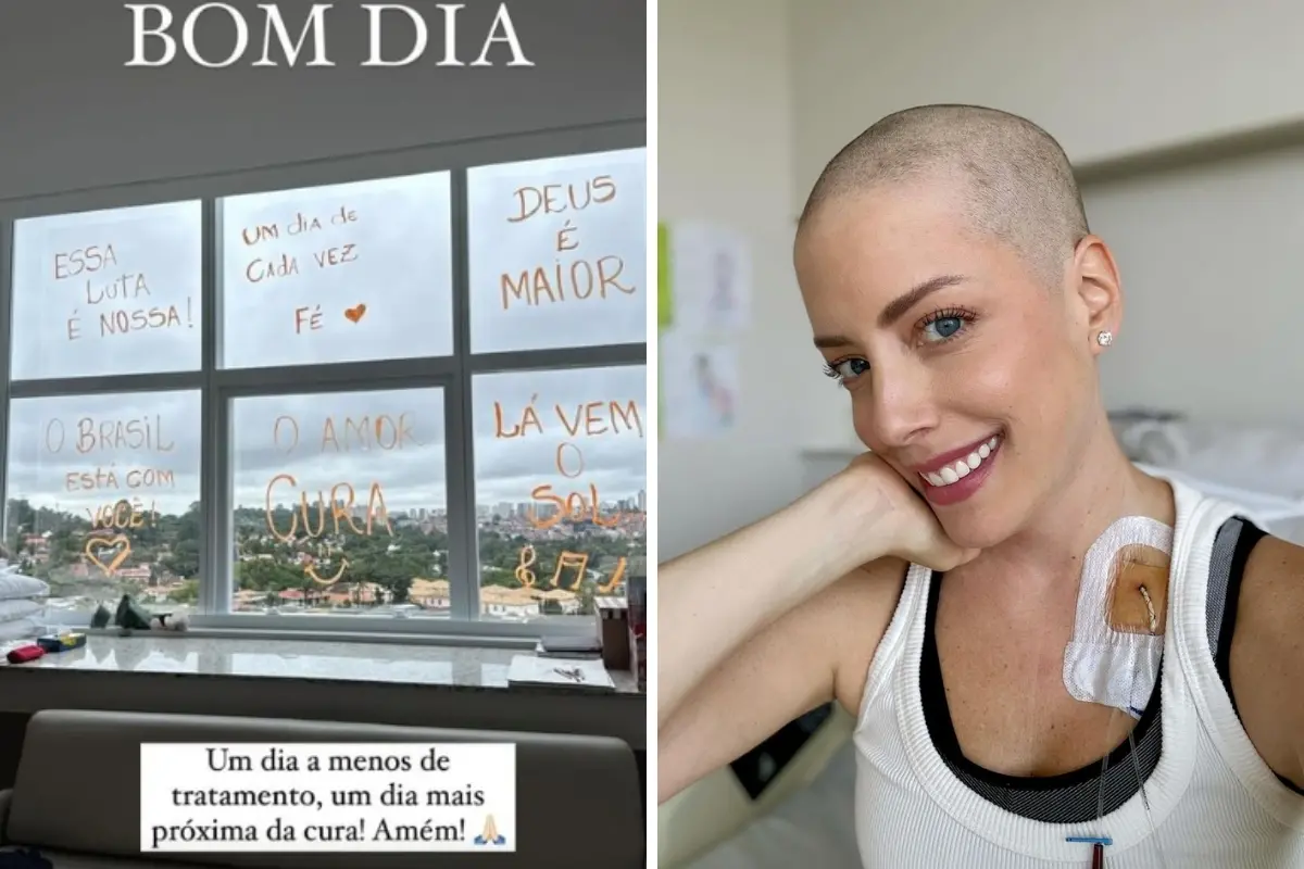 Imagem da notícia: Em tratamento contra a leucemia, Fabiana Justus desabafa: ‘Um dia a menos de tratamento’