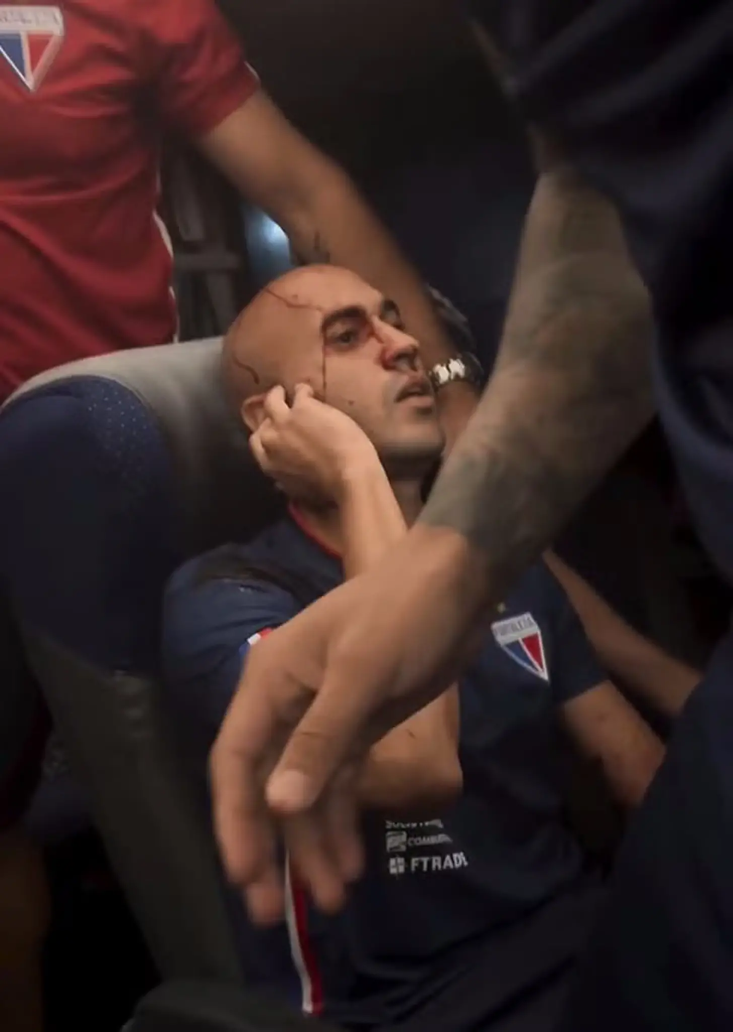 Imagem da notícia: Fortaleza atualiza situação médica dos jogadores feridos em atentado a ônibus