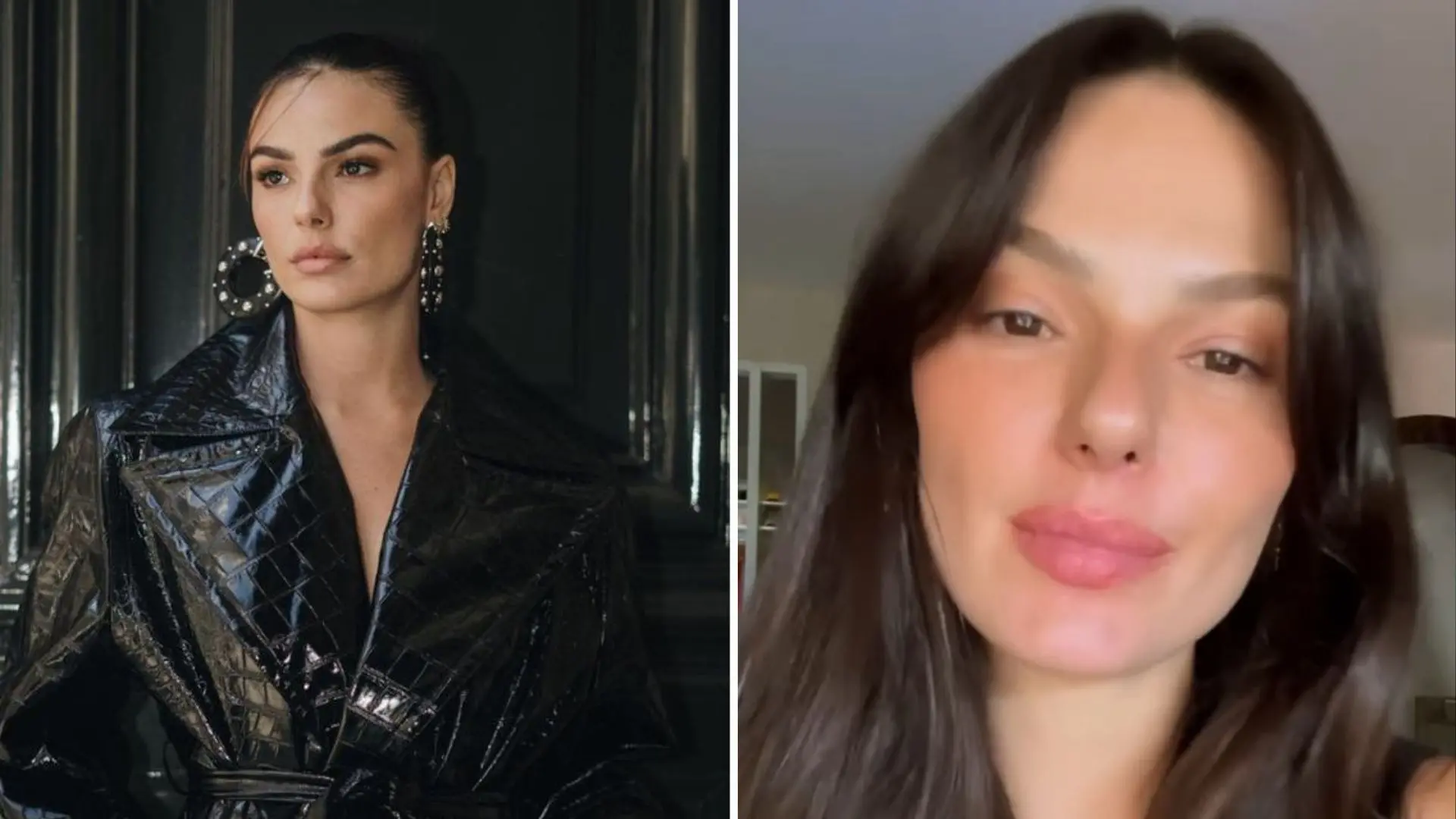 Imagem da notícia: Isis Valverde revela luta contra doença celíaca e como lida com diagnóstico: ‘Não é fácil’