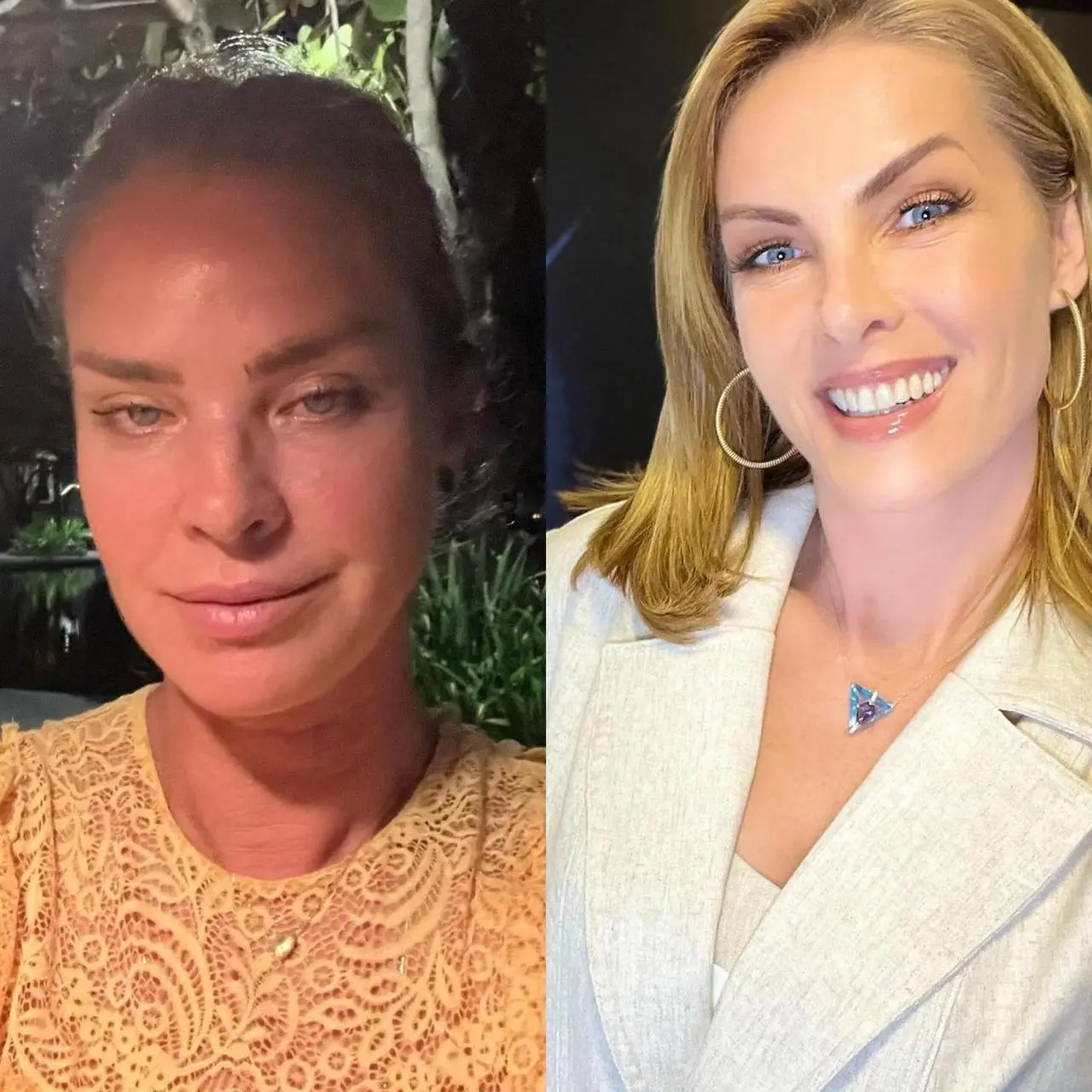 Imagem da notícia: Letícia Birkheuer denuncia ex-marido por agressão e recebe apoio de Ana Hickmann: 'Não está sozinha'