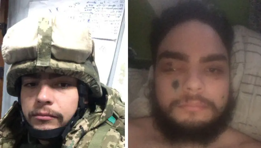 Imagem da notícia: Cearense ferido na Ucrânia pede doações para custear tratamento: 'Agradeço pela vida'