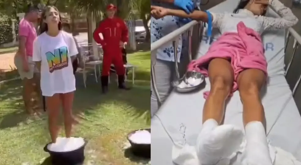 Imagem da notícia: Influenciadores queimam pés em balde gelo durante prova em reality promovido por Anderson Neiff