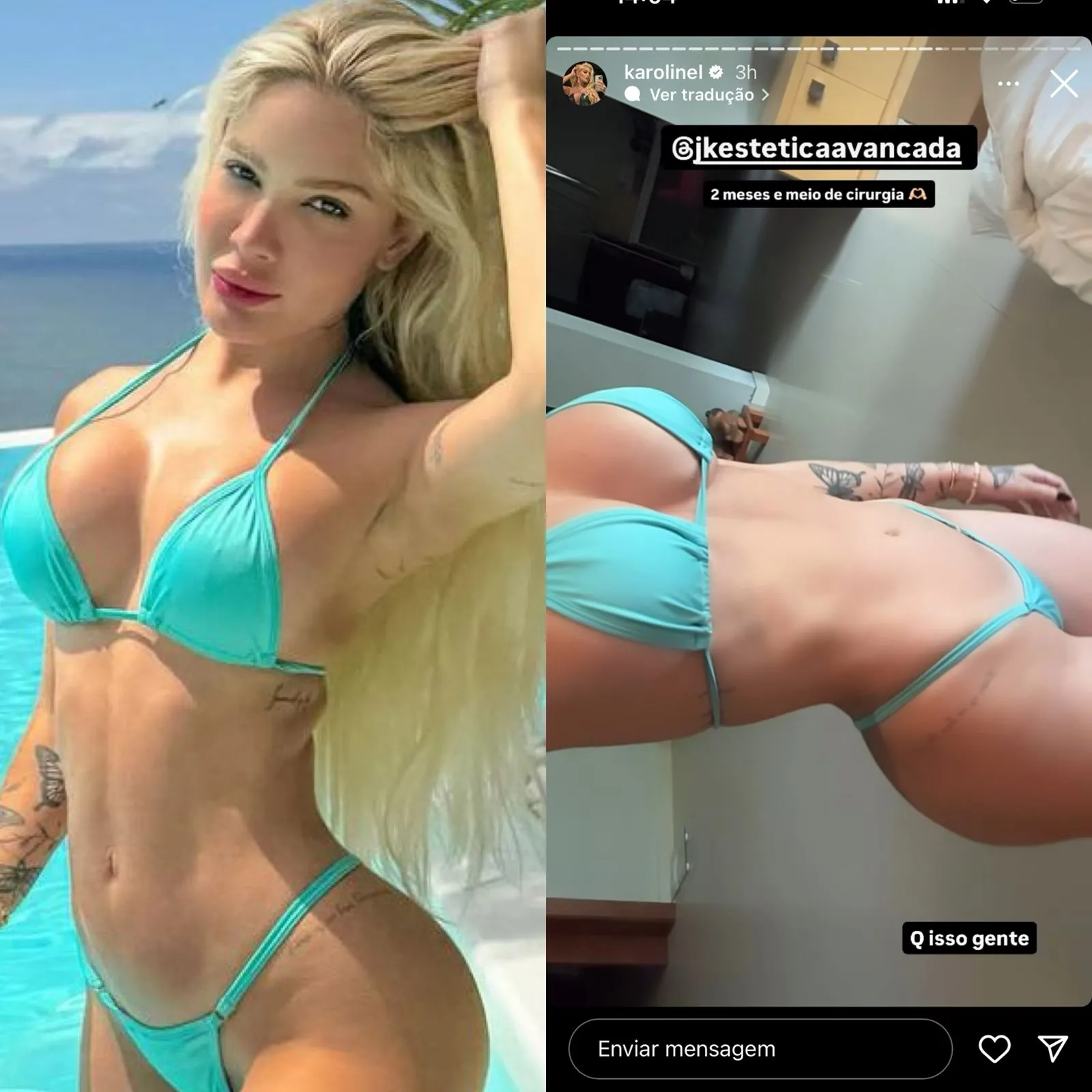 Karoline Lima exibiu o resultado nas redes sociais