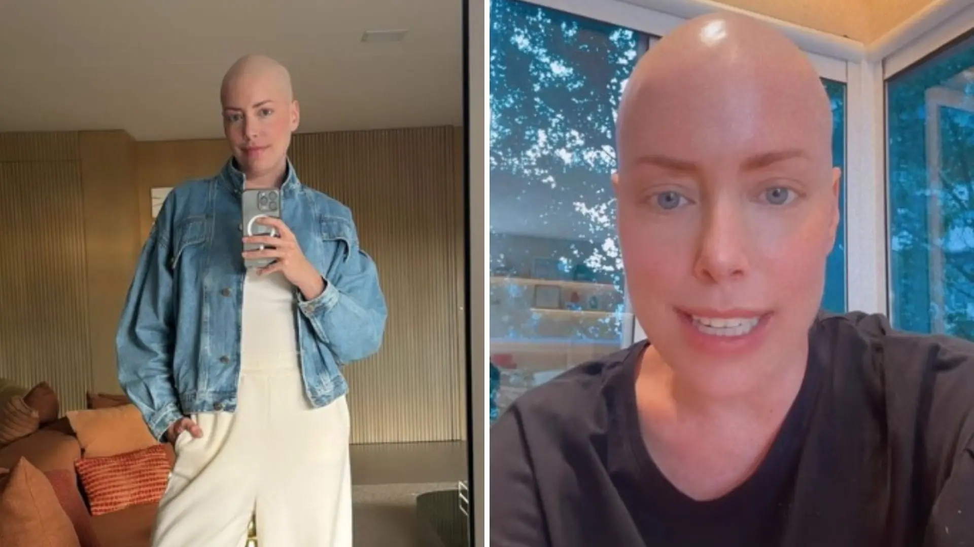 Imagem da notícia: Fabiana Justus relata rotina após transplante e diz que doador veio de fora do Brasil