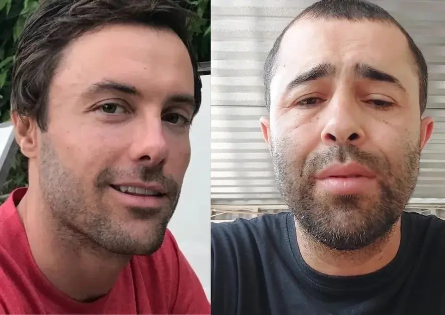 Imagem da notícia: Motorista que atropelou Kayky Brito insiste em perdão após ator publicar novo vídeo sobre acidente