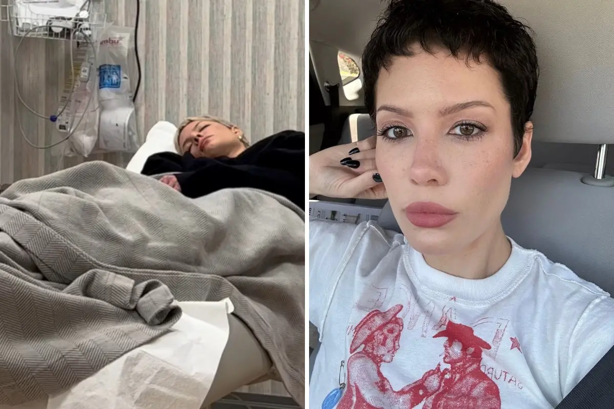 Imagem da notícia: Cantora Halsey revela luta contra lúpus e faz desabafo: 'Sorte de estar viva'