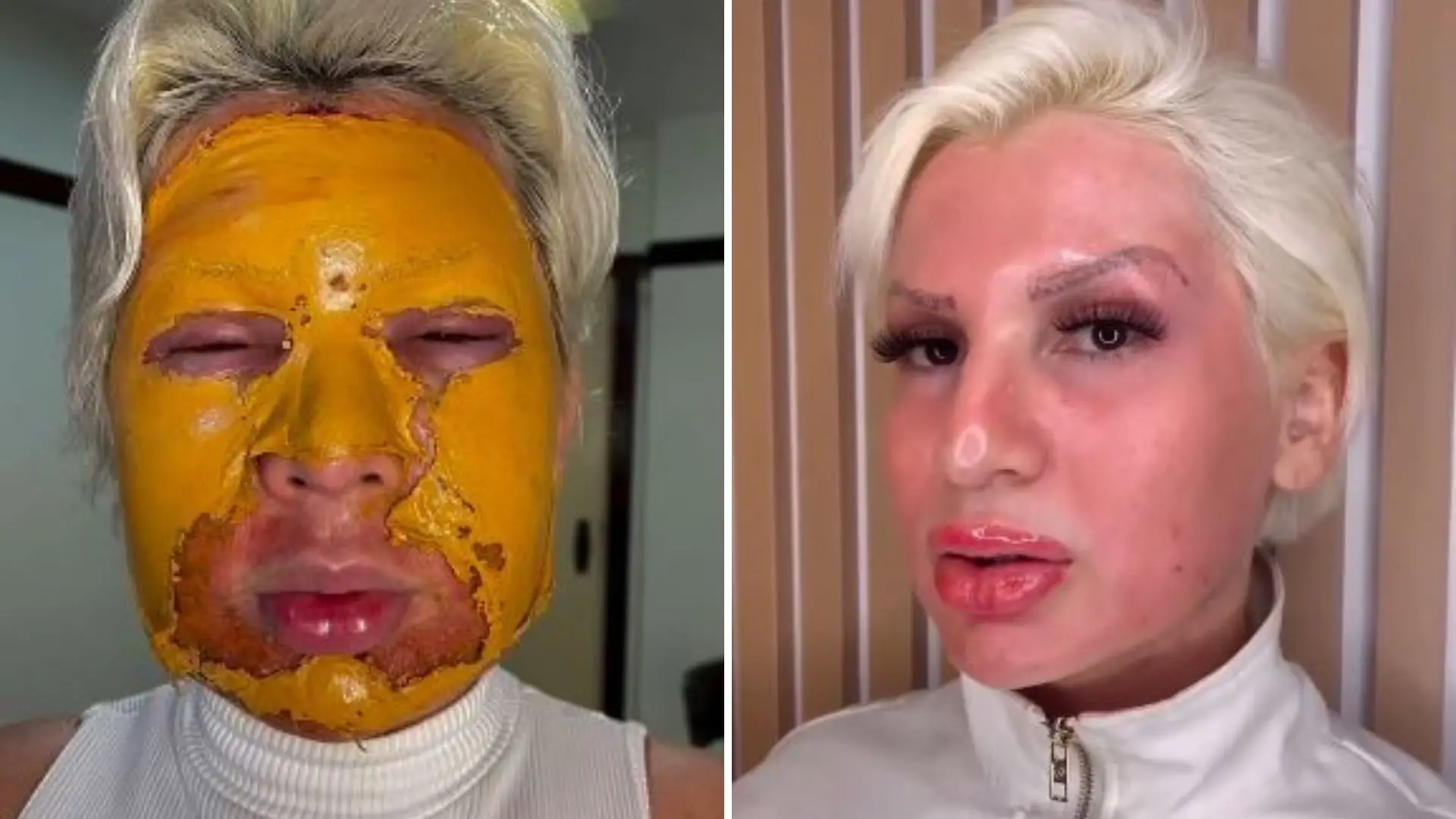 Imagem da notícia: Romagaga chora ao falar que fez peeling de fenol onde empresário morreu: 'Poderia ter sido eu'