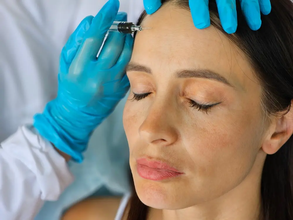 Aplicação de toxina botulínica em mulher branca adulta