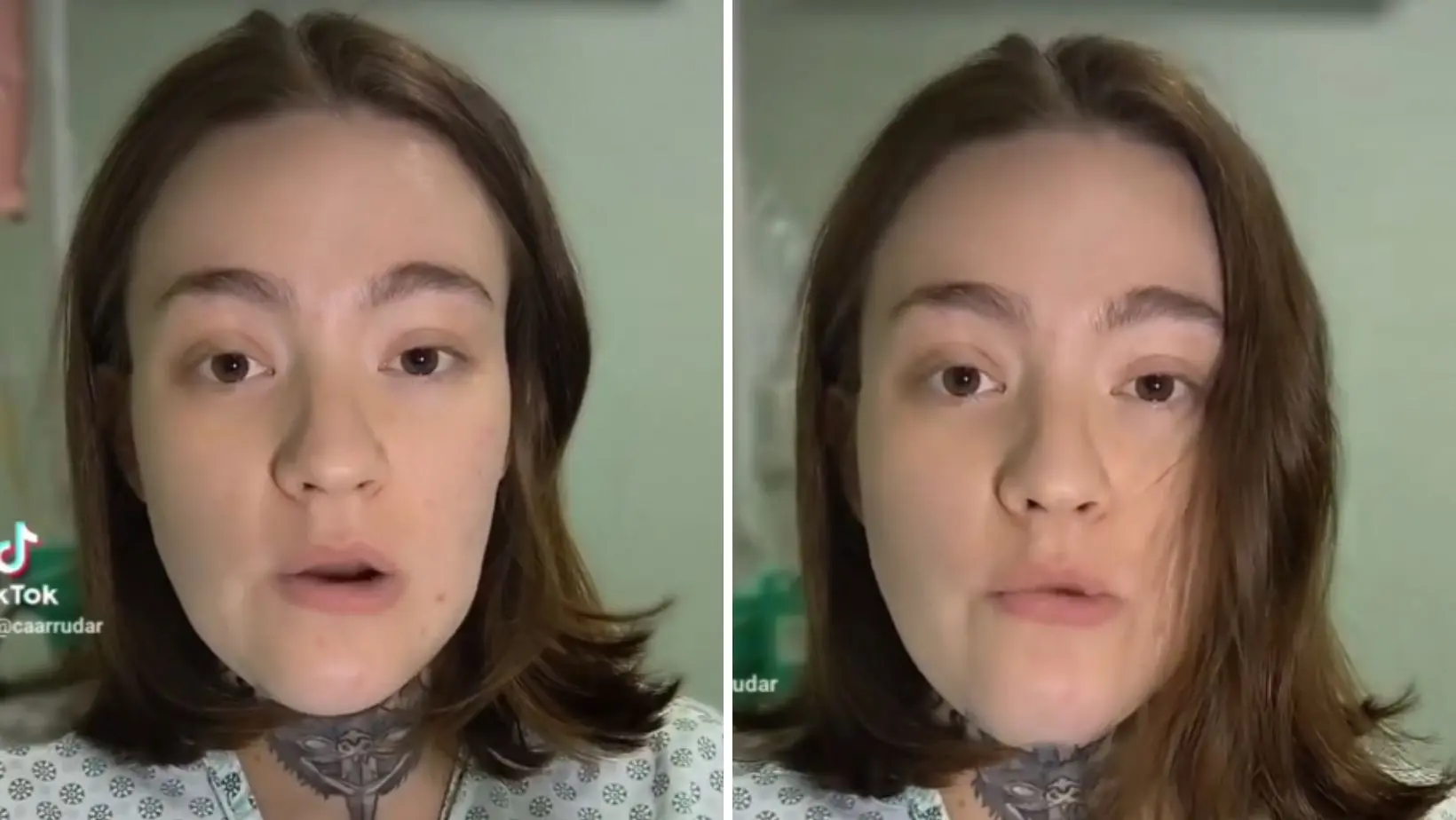 Imagem da notícia: Jovem com neuralgia do trigêmeo tem alta da UTI após tratamento: 'Experiência inédita'