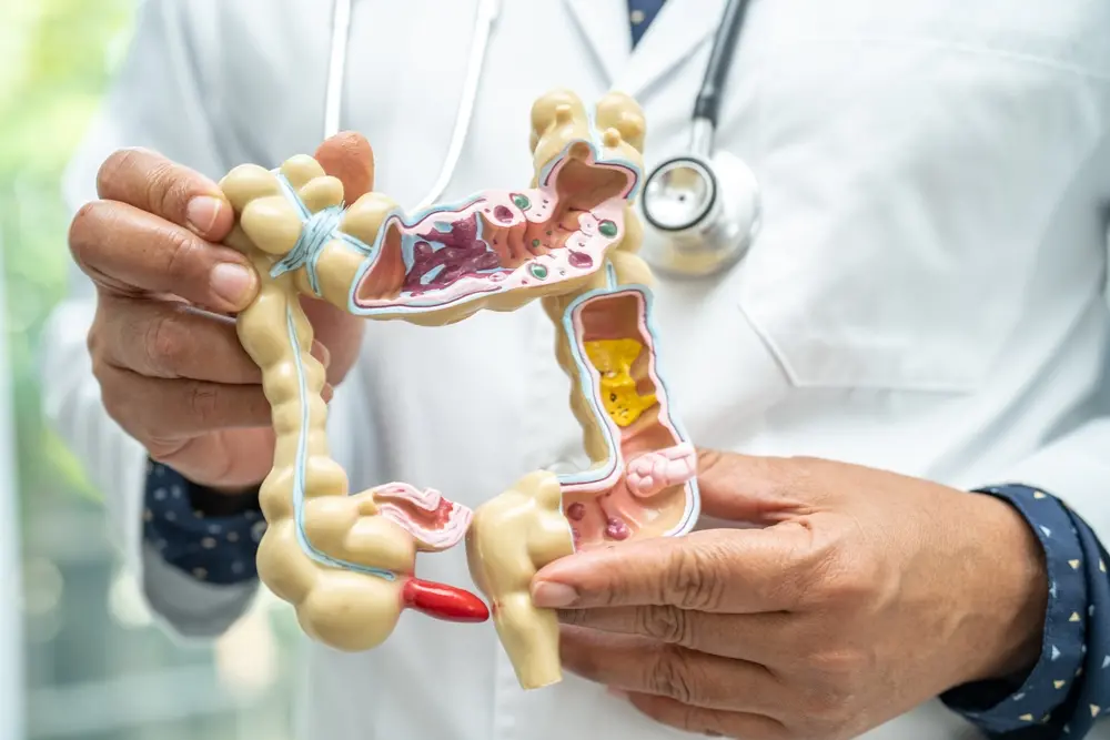 Imagem da notícia: Entenda o que é cirurgia no reto, como funciona e quando deve ser feita 