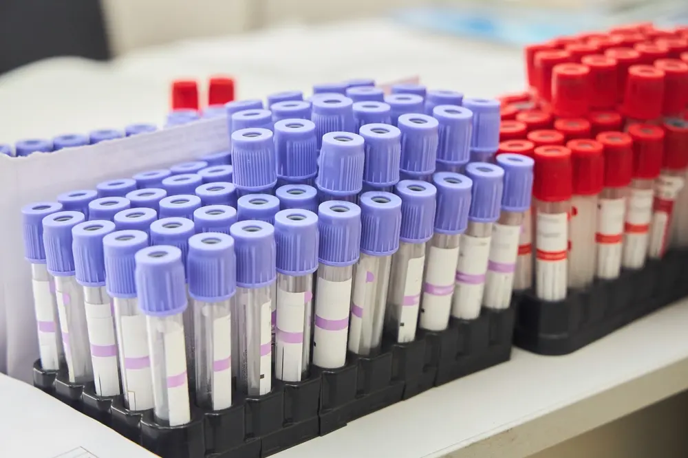 Imagem da notícia: Sócios e funcionários do laboratório PCS Saleme são denunciados após caso de contaminação por HIV