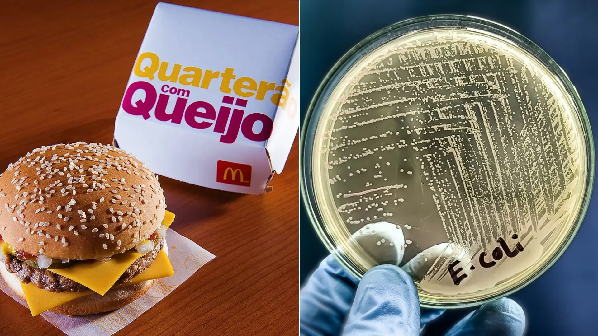 Imagem da notícia: Entenda o que é a E. coli O157, bactéria associada ao lanche do McDonald's, e o que pode causar