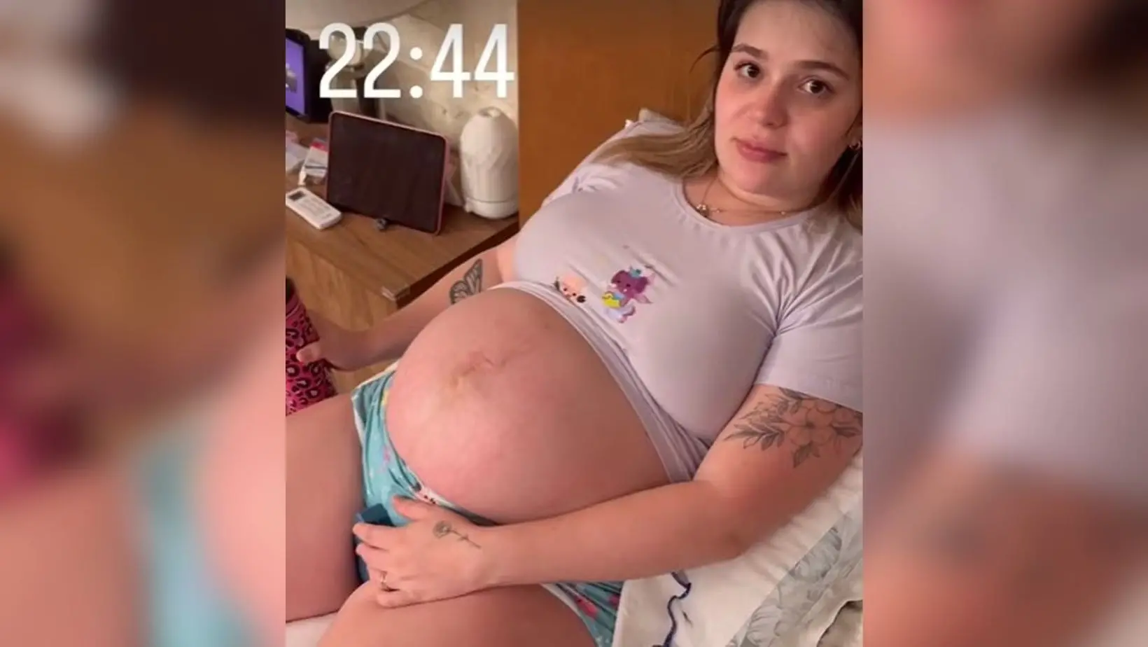 Imagem da notícia: O que é pubalgia, inflamação que afeta Viih Tube no final da gravidez e causa fortes dores