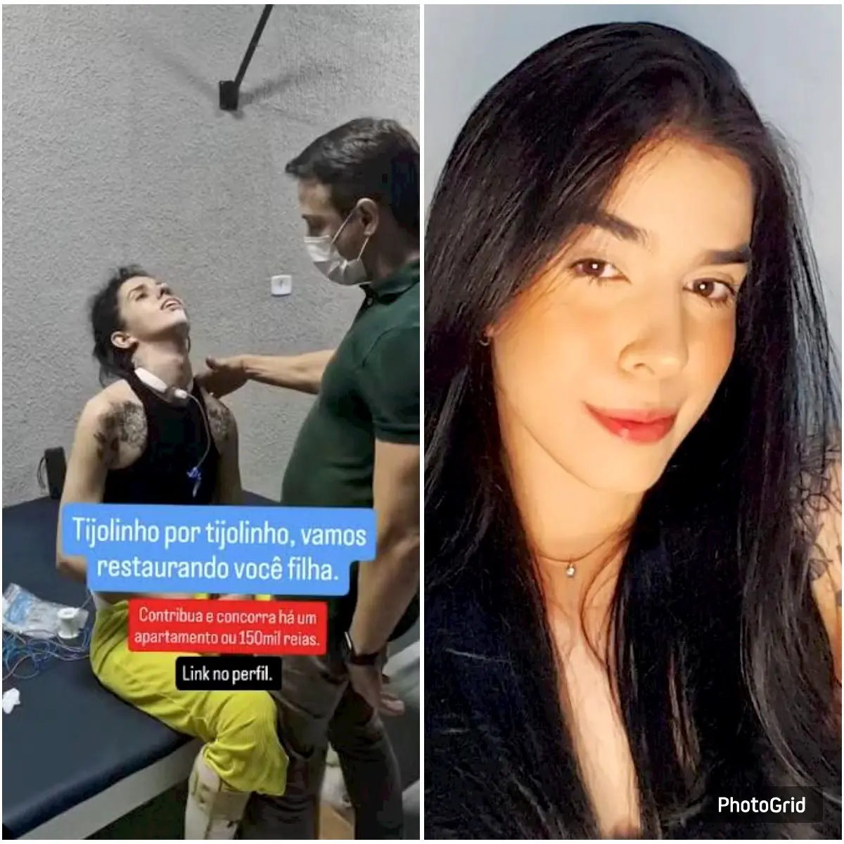 Imagem da notícia: Jovem que teve reação alérgica ao cheirar pimenta mostra melhora durante tratamento; veja