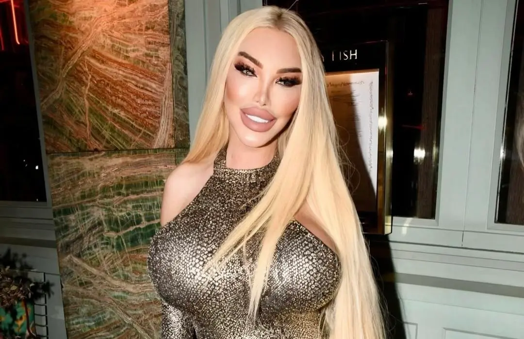 Imagem da notícia: Jessica Alves foi hospitalizada com buraco no bumbum após picada de abelha