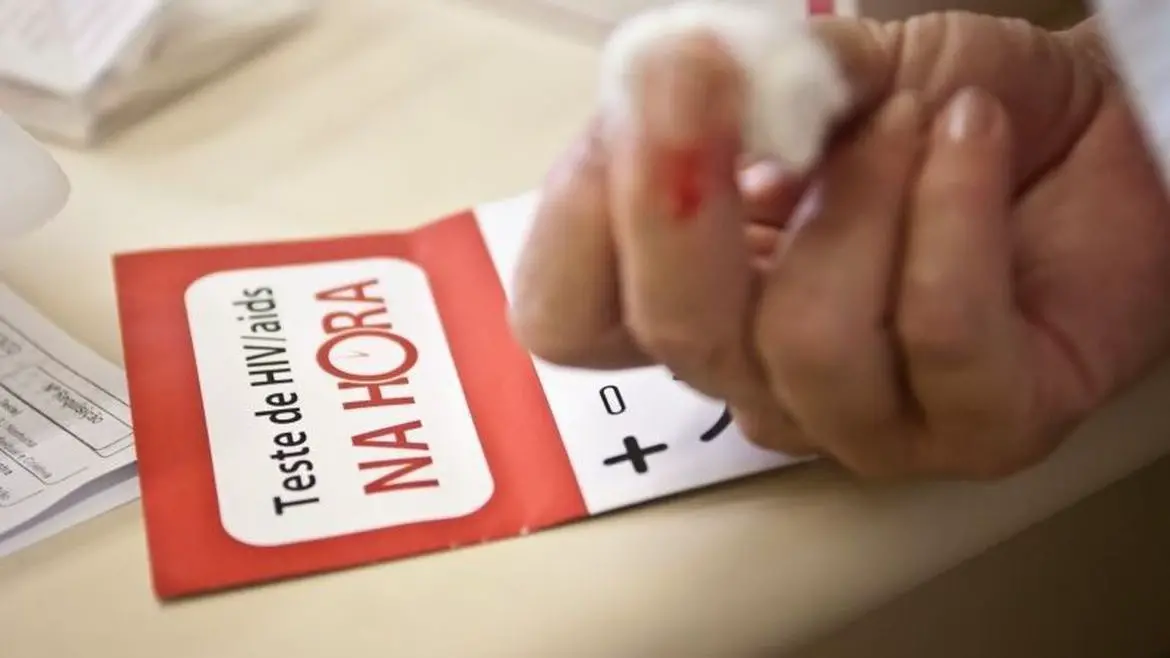 Imagem da notícia: Brasil registrou mais de dez mil casos de aids em 2023, mas taxa de mortalidade é a menor desde 2013