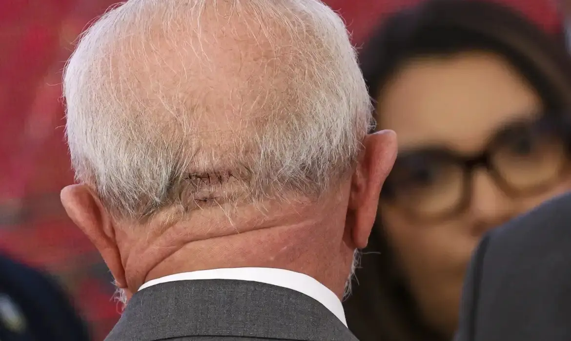 Imagem da notícia: Lula retira dreno intracraniano após novo procedimento, atualiza boletim médico