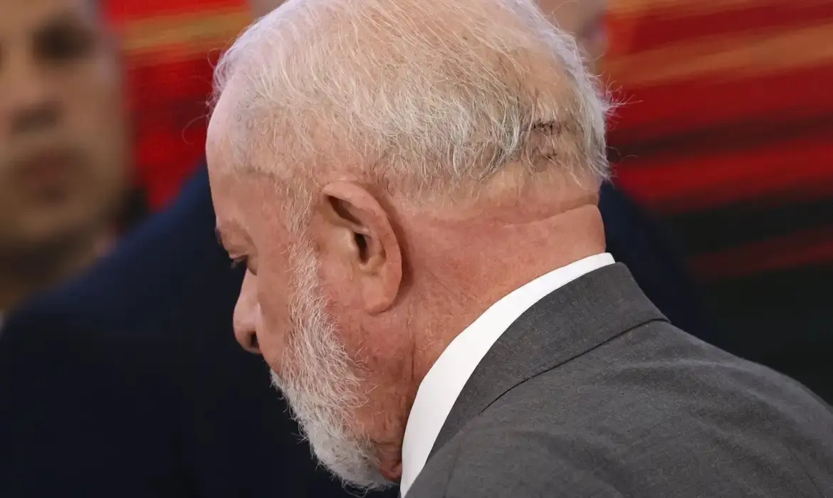 Imagem da notícia: Embolização das artérias meníngeas, novo procedimento de Lula, é simples e de baixo risco