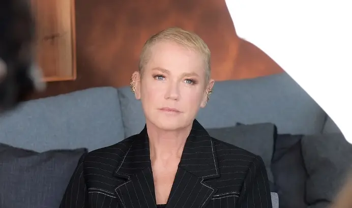Imagem da notícia: Entenda o que é alopecia androgenética, condição diagnosticada em Xuxa