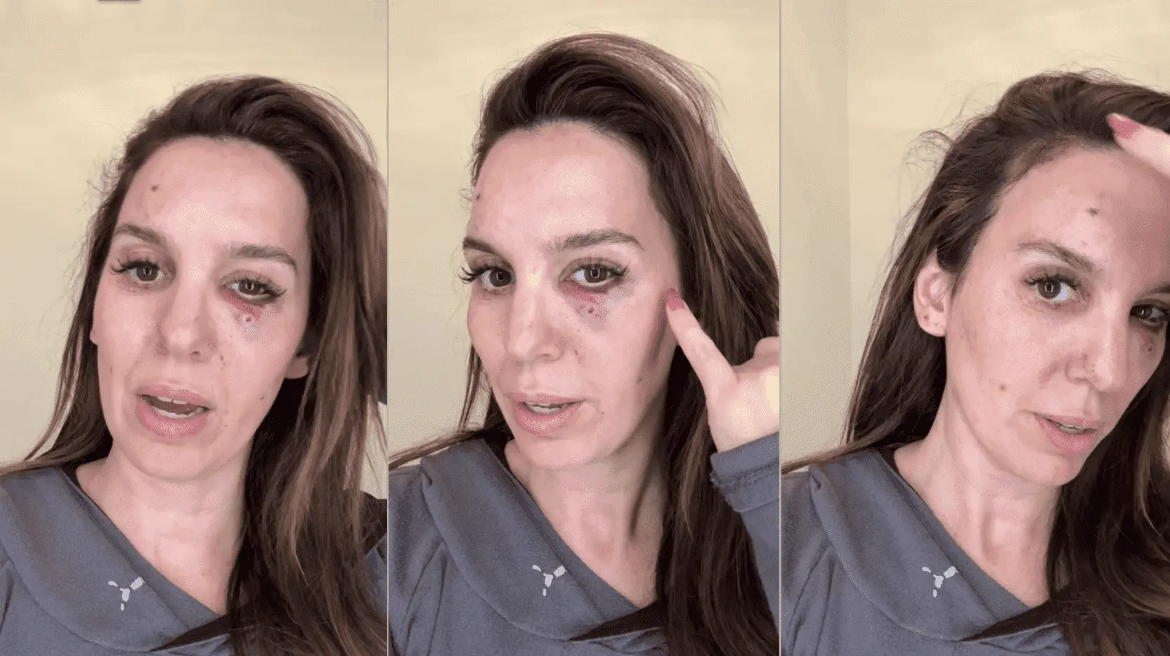Imagem da notícia: Ex-atriz da Disney, Christy Carlson Romano sofre tiro acidental no rosto durante aniversário do marido: 'Direção errada'