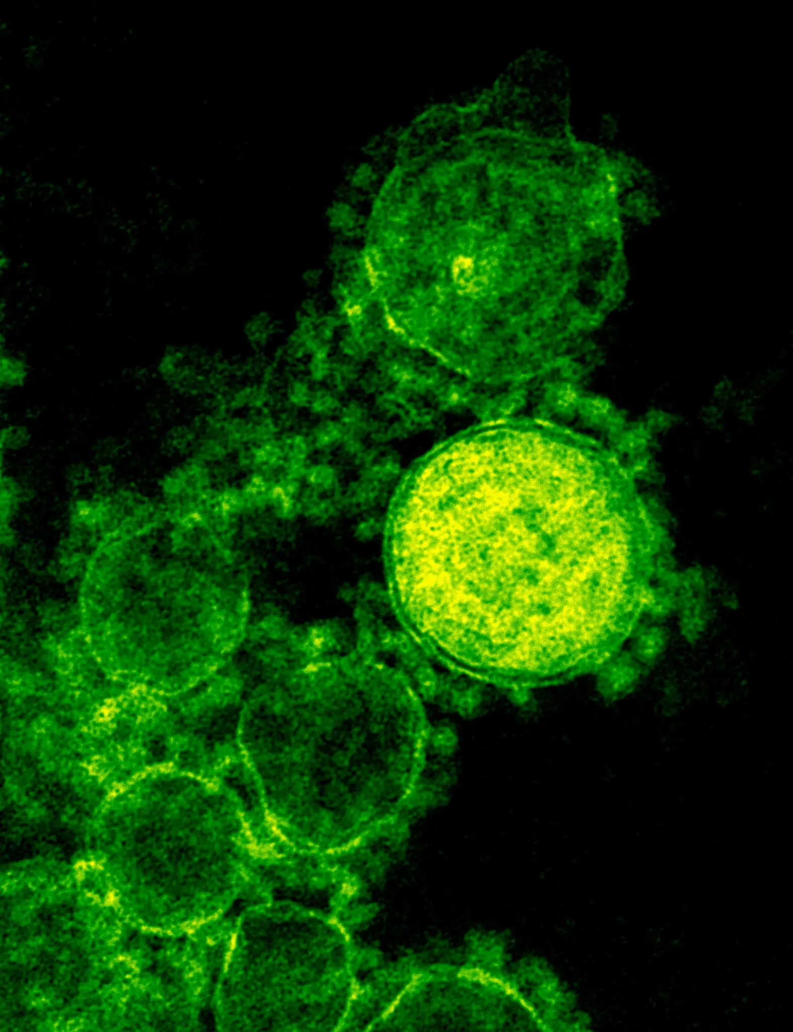 Imagem microscópica do vírus MERS-Cov