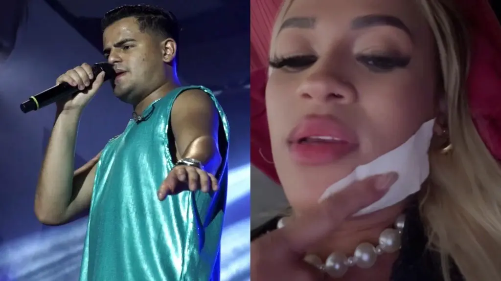 Imagem da notícia: Backing vocal de Heitor Costa é ferida com copo de vidro e cantor encerra show em Pernambuco
