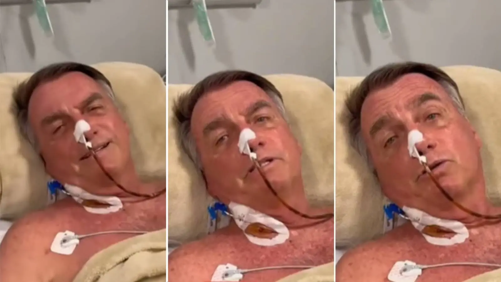 Imagem da notícia: Bolsonaro segue hospitalizado em UTI e sem previsão de alta após cirurgia; entenda pós-operatório