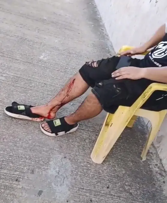 Imagem da notícia: Torcedor do Colo-Colo é baleado em assalto na Praia de Iracema 