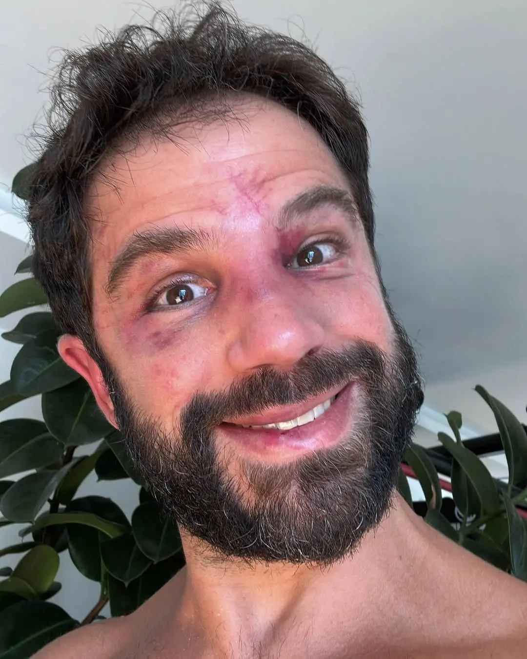 Imagem da notícia Duda Nagle é barrado em academia após luta contra Popó