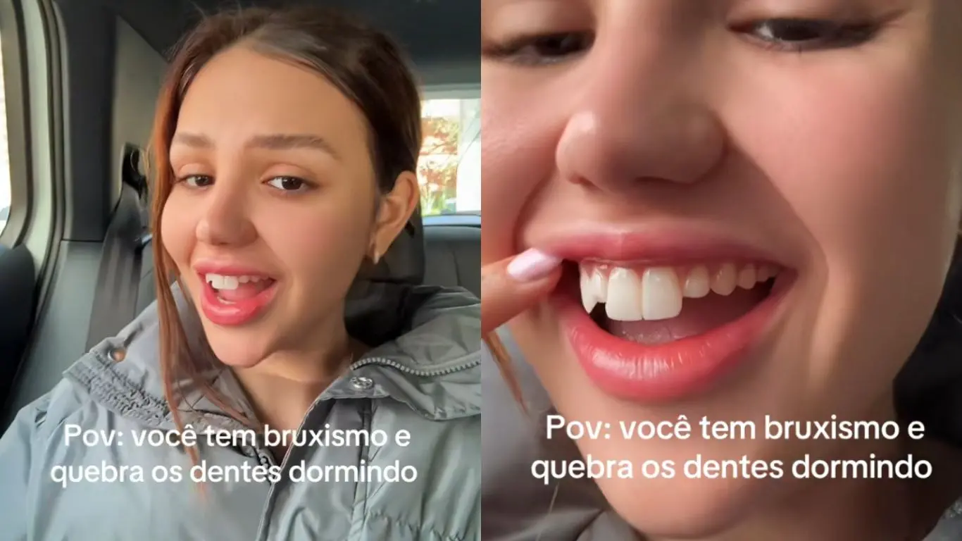 Imagem da notícia: Vivi Wanderley quebra lentes dentais durante o sono por causa de bruxismo