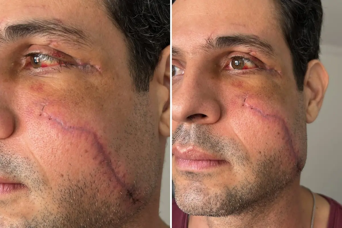 Imagem da notícia Após empresário ser agredido com copo de vidro, família relata abandono e cobra providências