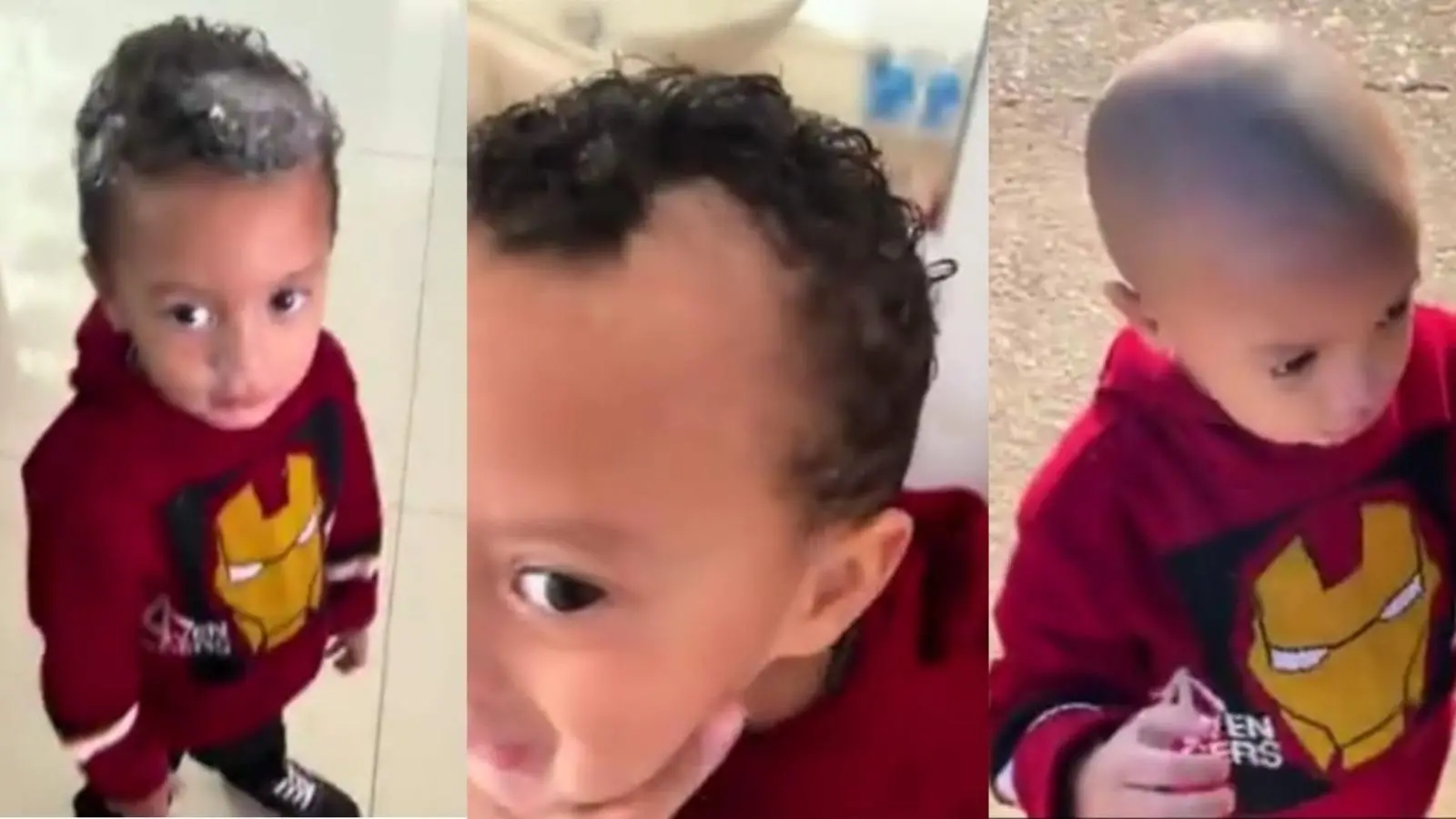 Imagem da notícia Criança usa creme depilatório na cabeça, perde todo o cabelo e vídeo viraliza nas redes sociais
