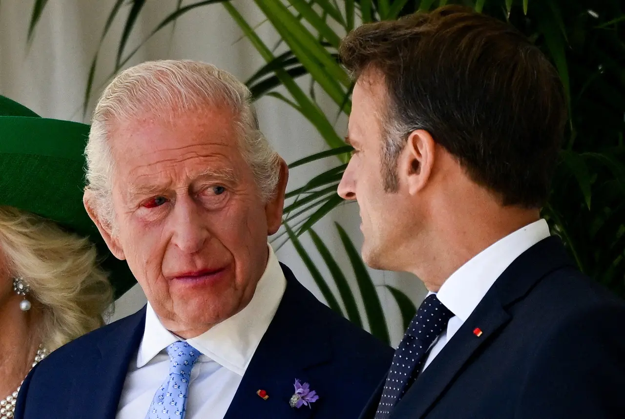 Imagem da notícia Olho vermelho de Rei Charles III chama atenção em encontro com Macron; entenda condição