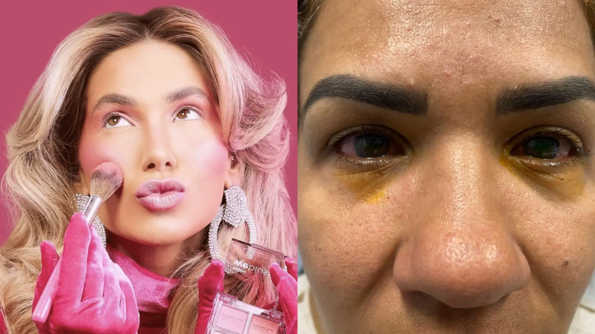 Imagem da notícia: WePink responde consumidora que relatou cegueira após usar maquiagem da marca