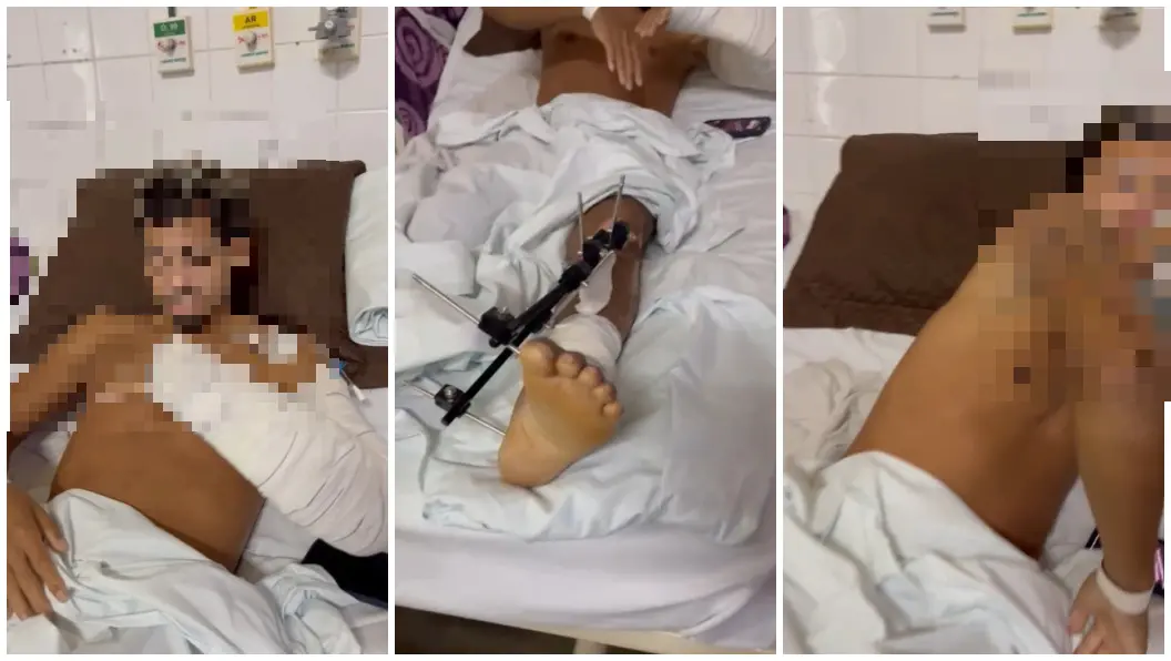 Imagem da notícia Garupeiro da moto de Kauã Guedes fala pela 1ª vez após acidente: 