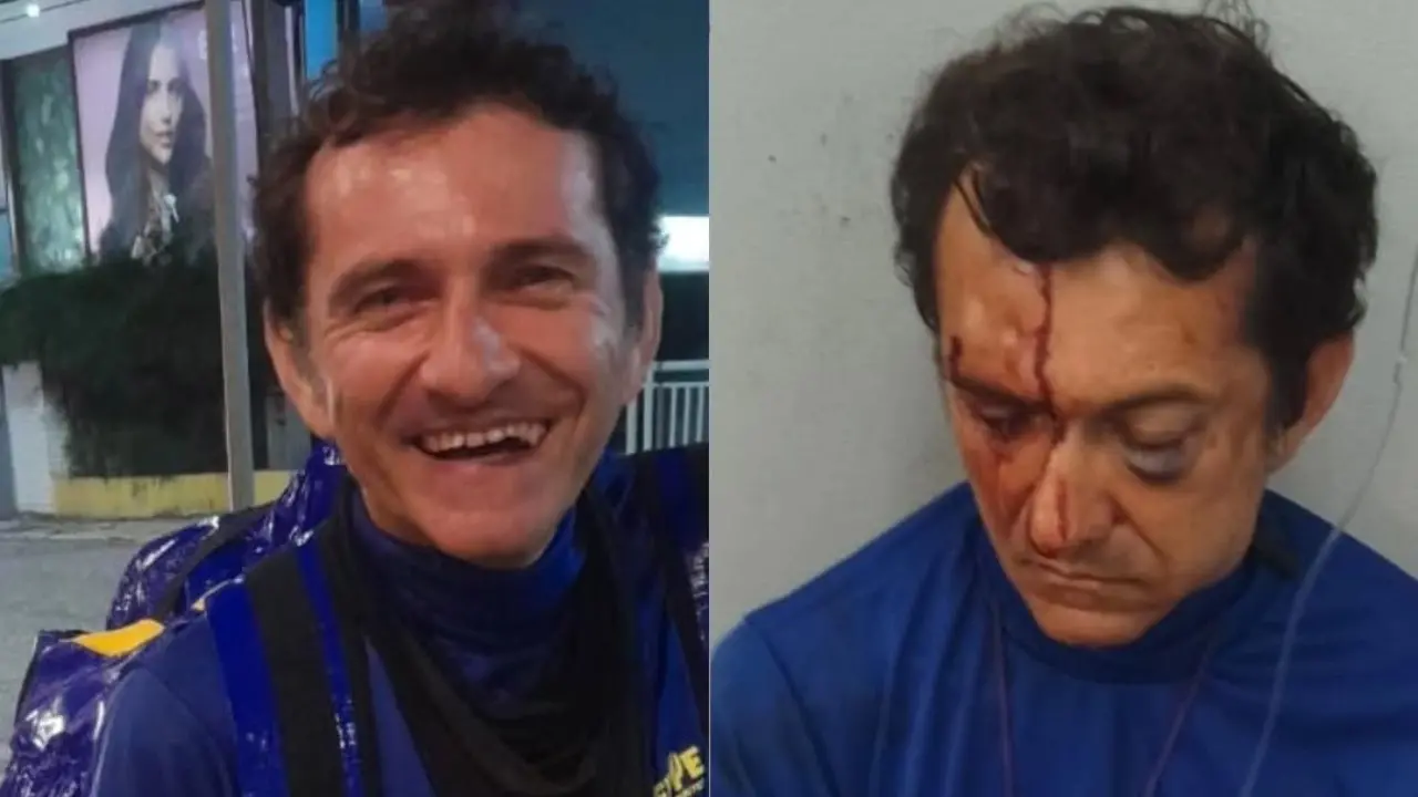 Imagem da notícia: Entregador de app agredido por cliente no Meireles fraturou osso perto do olho: 'Me chutou na cara'