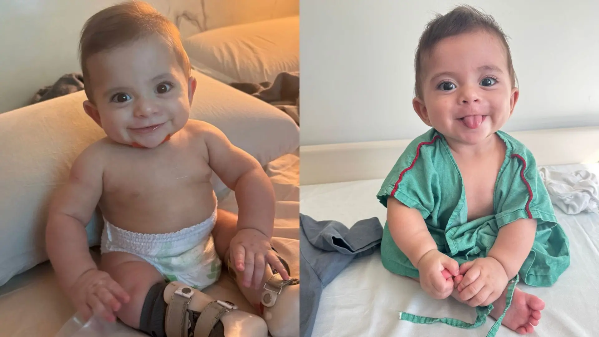 Imagem da notícia: Bebê nasce com doença rara e pais lançam vaquinha para custear cirurgia inédita
