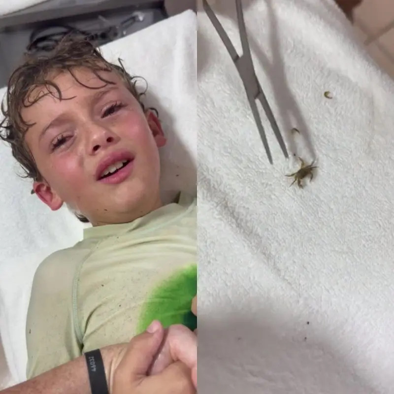 Imagem da notícia: Caranguejo vivo é retirado do ouvido de filho de influenciadora no México