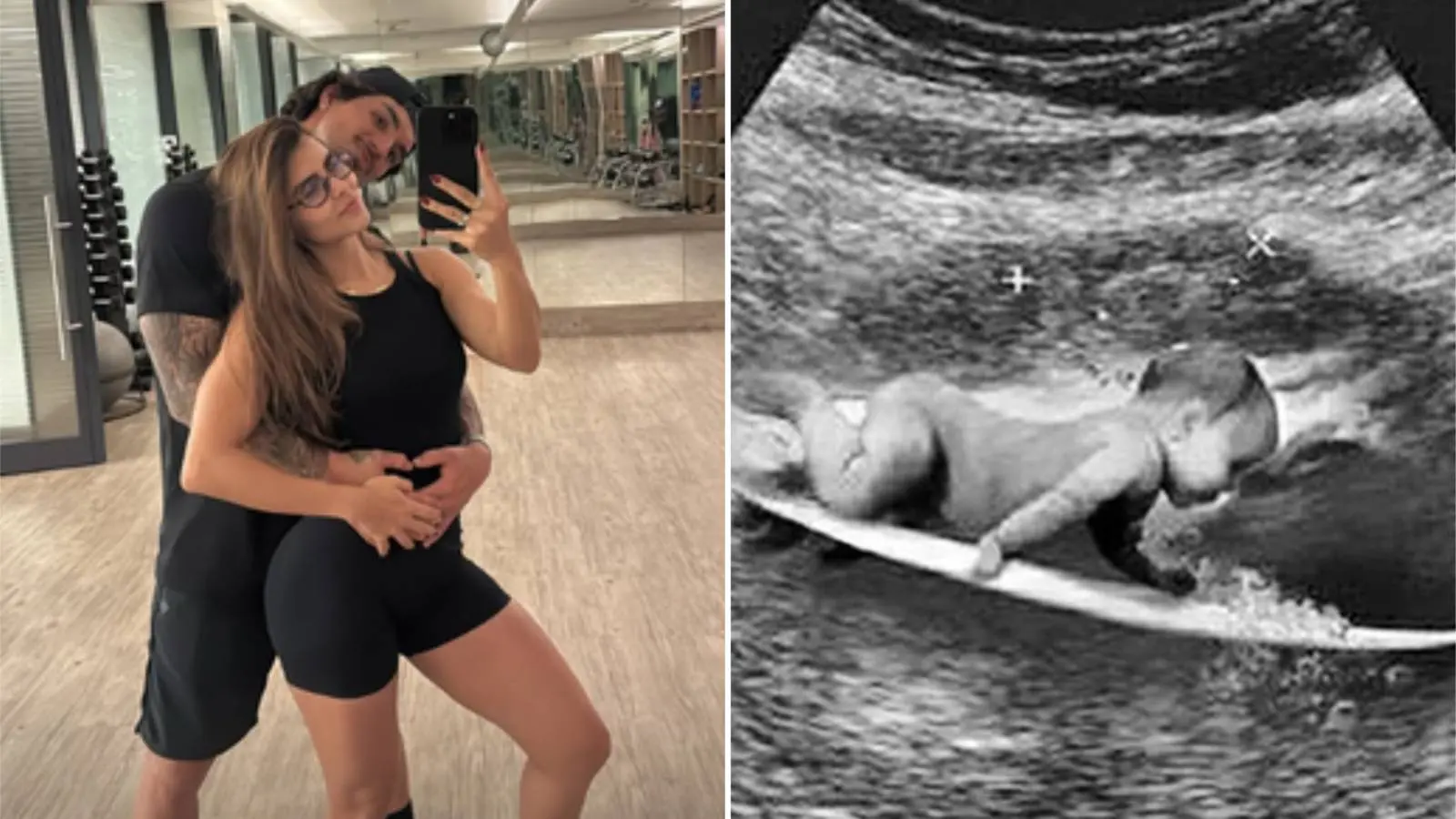 Imagem da notícia: Gabriel Medina e Isabella Arantes esperam primeiro filho