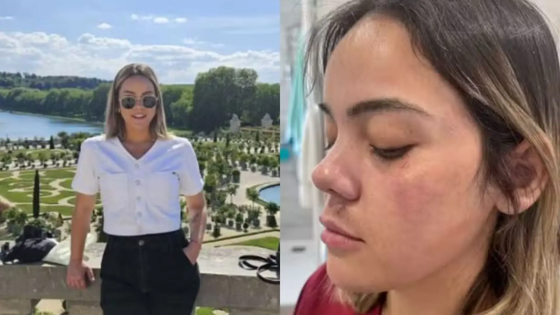 Imagem da notícia: Brasileira deixa País após violência doméstica e sofre tentativa de estupro em Paris