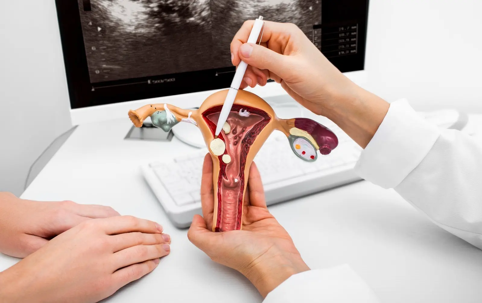 Ginecologista explica o funcionamento de pólipos no útero a partir de uma representação em 3D.