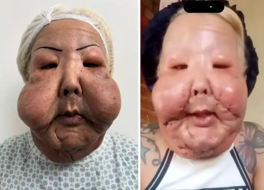 Imagem da notícia Médico detalha evolução da cicatrização de Juju do Pix