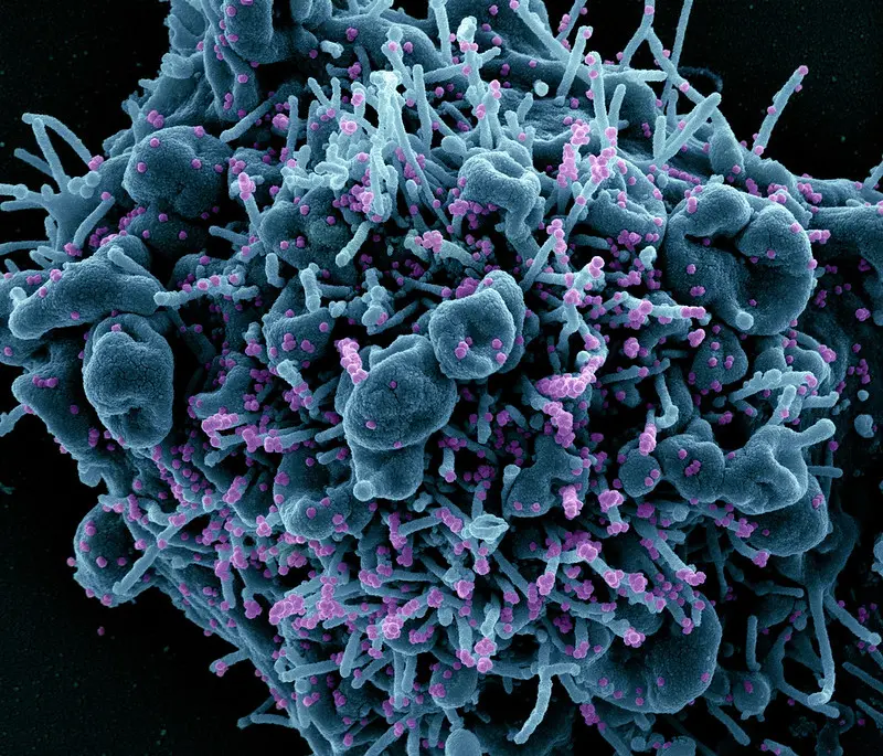 Imagem da notícia: Ceará investiga 55 pacientes suspeitos de infecção por cepa do novo coronavírus vinda de Manaus