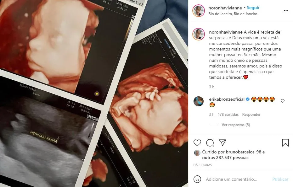 Influenciadora postou registros da ultrassonografia no Instagram