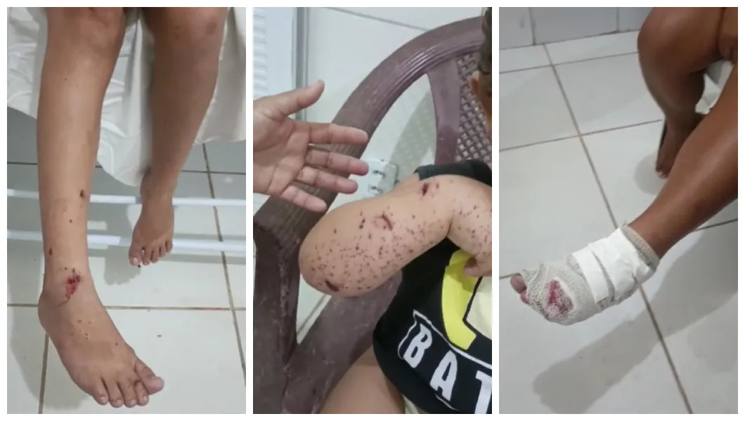 Duas mulheres e uma criança de dois anos ficaram feridas