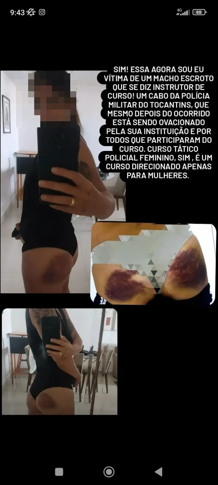 A policial foi vítima de pauladas