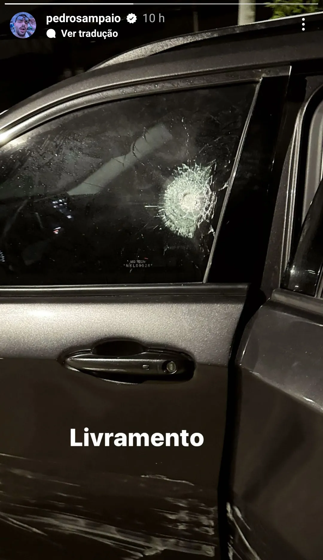 Imagem foi compartilhada nos Stories do perfil do artista