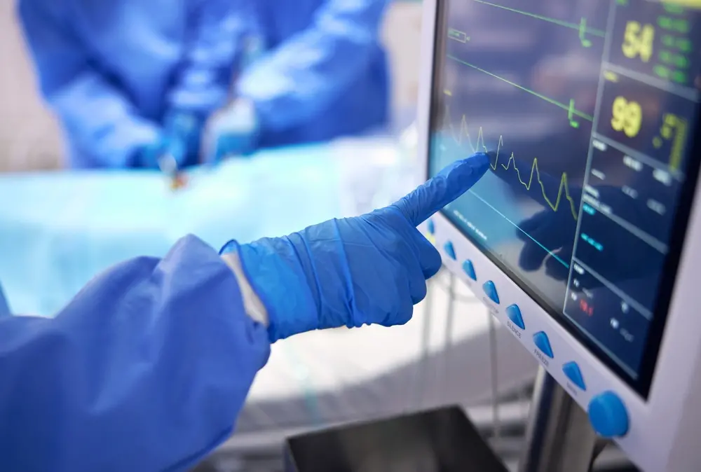 Foto ilustrativa de ECG