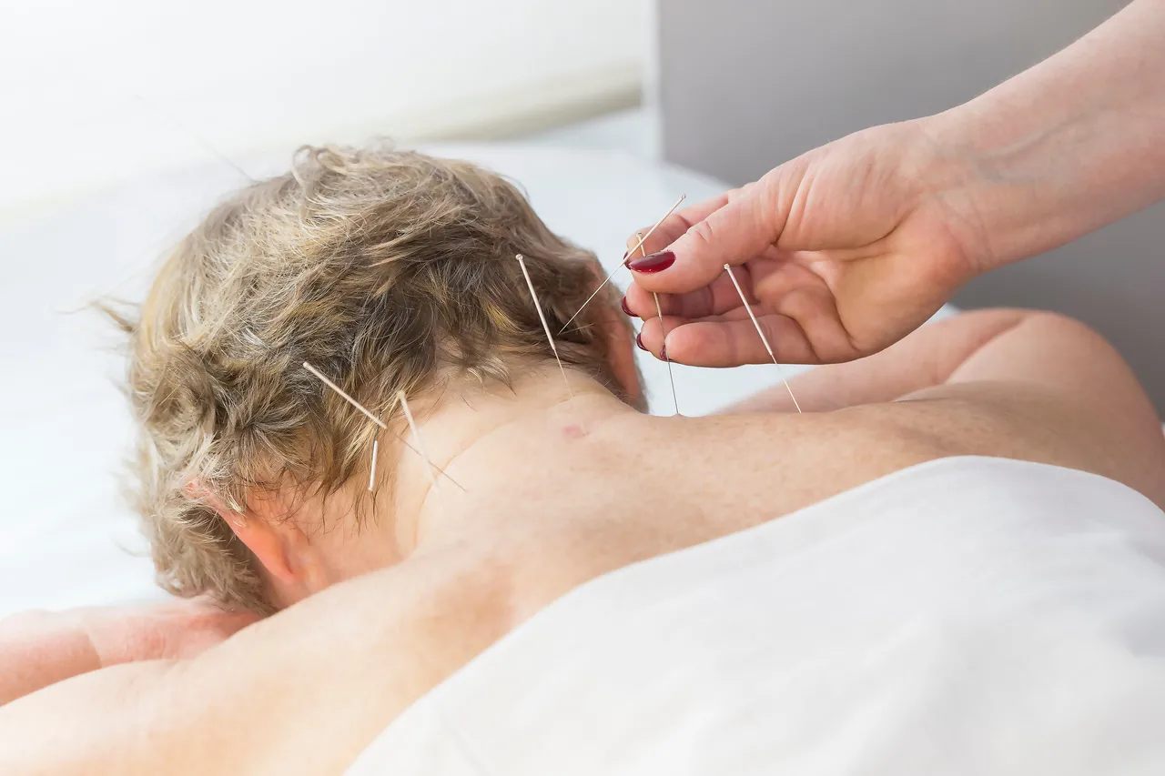 A acupuntura é um tratamento complementar eficaz para aliviar os sintomas do climatério, como ondas de calor, irritabilidade e distúrbios do sono.